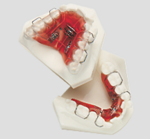 sagittal3Screw
